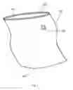 Fig. 02 - Methods and devices for removing a tissue specimen from a patient