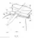 Fig. 19 - Methods and devices for removing a tissue specimen from a patient