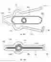 Fig. 20 - Methods and devices for removing a tissue specimen from a patient