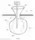 Fig. 22 - Methods and devices for removing a tissue specimen from a patient