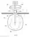 Fig. 28 - Methods and devices for removing a tissue specimen from a patient
