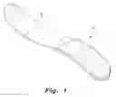 Fig. 02 - Tissue protection system and method