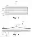 Fig. 04 - Tissue protection system and method