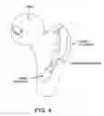 Fig. 05 - Method and apparatus for distracting a joint