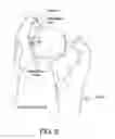 Fig. 09 - Method and apparatus for distracting a joint