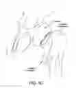 Fig. 11 - Method and apparatus for distracting a joint