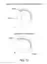 Fig. 14 - Method and apparatus for distracting a joint