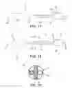 Fig. 18 - Method and apparatus for distracting a joint