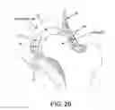 Fig. 27 - Method and apparatus for distracting a joint