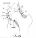 Fig. 29 - Method and apparatus for distracting a joint