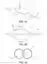 Fig. 36 - Method and apparatus for distracting a joint