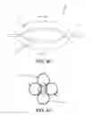 Fig. 38 - Method and apparatus for distracting a joint