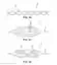 Fig. 40 - Method and apparatus for distracting a joint