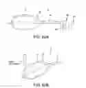 Fig. 43 - Method and apparatus for distracting a joint