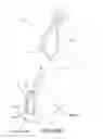 Fig. 45 - Method and apparatus for distracting a joint