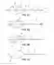 Fig. 49 - Method and apparatus for distracting a joint