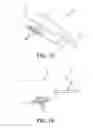 Fig. 51 - Method and apparatus for distracting a joint