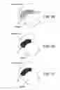 Fig. 52 - Method and apparatus for distracting a joint