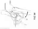 Fig. 57 - Method and apparatus for distracting a joint