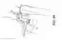 Fig. 59 - Method and apparatus for distracting a joint