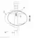 Fig. 72 - Method and apparatus for distracting a joint