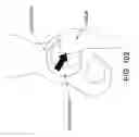 Fig. 75 - Method and apparatus for distracting a joint