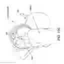 Fig. 83 - Method and apparatus for distracting a joint