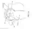 Fig. 84 - Method and apparatus for distracting a joint