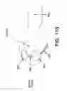 Fig. 88 - Method and apparatus for distracting a joint