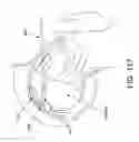 Fig. 90 - Method and apparatus for distracting a joint