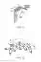 Fig. 15 - Methods and devices for the prevention of incisional surgical site infections