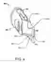 Fig. 04 - Medical device for cutting