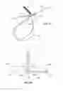 Fig. 06 - BONE AND JOINT STABILIZATION DEVICE FEATURES