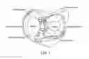 Fig. 02 - Anchor/implant deployment device and tissue repair methods related thereto