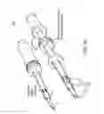 Fig. 07 - Anchor/implant deployment device and tissue repair methods related thereto