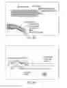 Fig. 11 - Anchor/implant deployment device and tissue repair methods related thereto