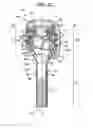 Fig. 05 - Surgical access devices with integrated wound closure features