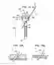 Fig. 20 - Surgical access devices with integrated wound closure features