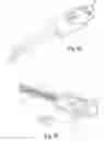 Fig. 18 - Surgical apparatus
