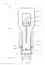 Fig. 01 - Bone implant with means for multi directional force and means of insertion