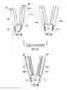 Fig. 03 - Bone implant with means for multi directional force and means of insertion
