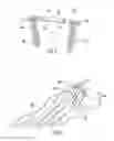 Fig. 04 - Bone implant with means for multi directional force and means of insertion