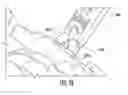 Fig. 19 - Bone implant with means for multi directional force and means of insertion