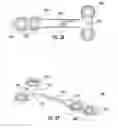 Fig. 24 - Bone implant with means for multi directional force and means of insertion