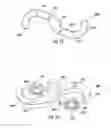 Fig. 30 - Bone implant with means for multi directional force and means of insertion