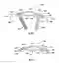 Fig. 41 - Bone implant with means for multi directional force and means of insertion