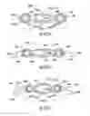 Fig. 42 - Bone implant with means for multi directional force and means of insertion