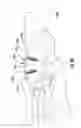 Fig. 49 - Bone implant with means for multi directional force and means of insertion