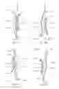Fig. 60 - Bone implant with means for multi directional force and means of insertion