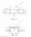 Fig. 02 - SURGICAL STAPLES